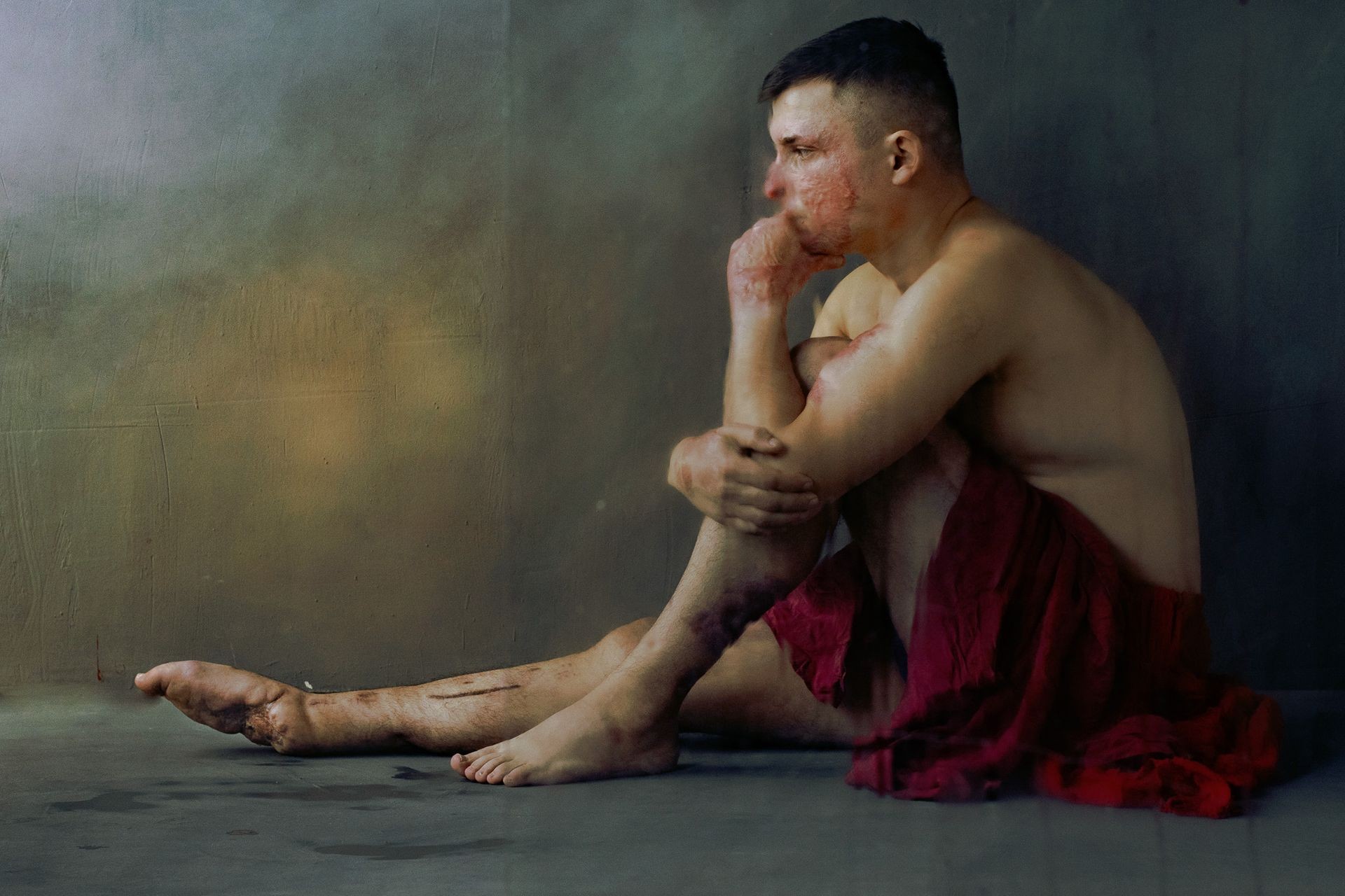Ukrainian artist's 'Sculpture' series normalizes injured bodies of Ukraine's soldiers