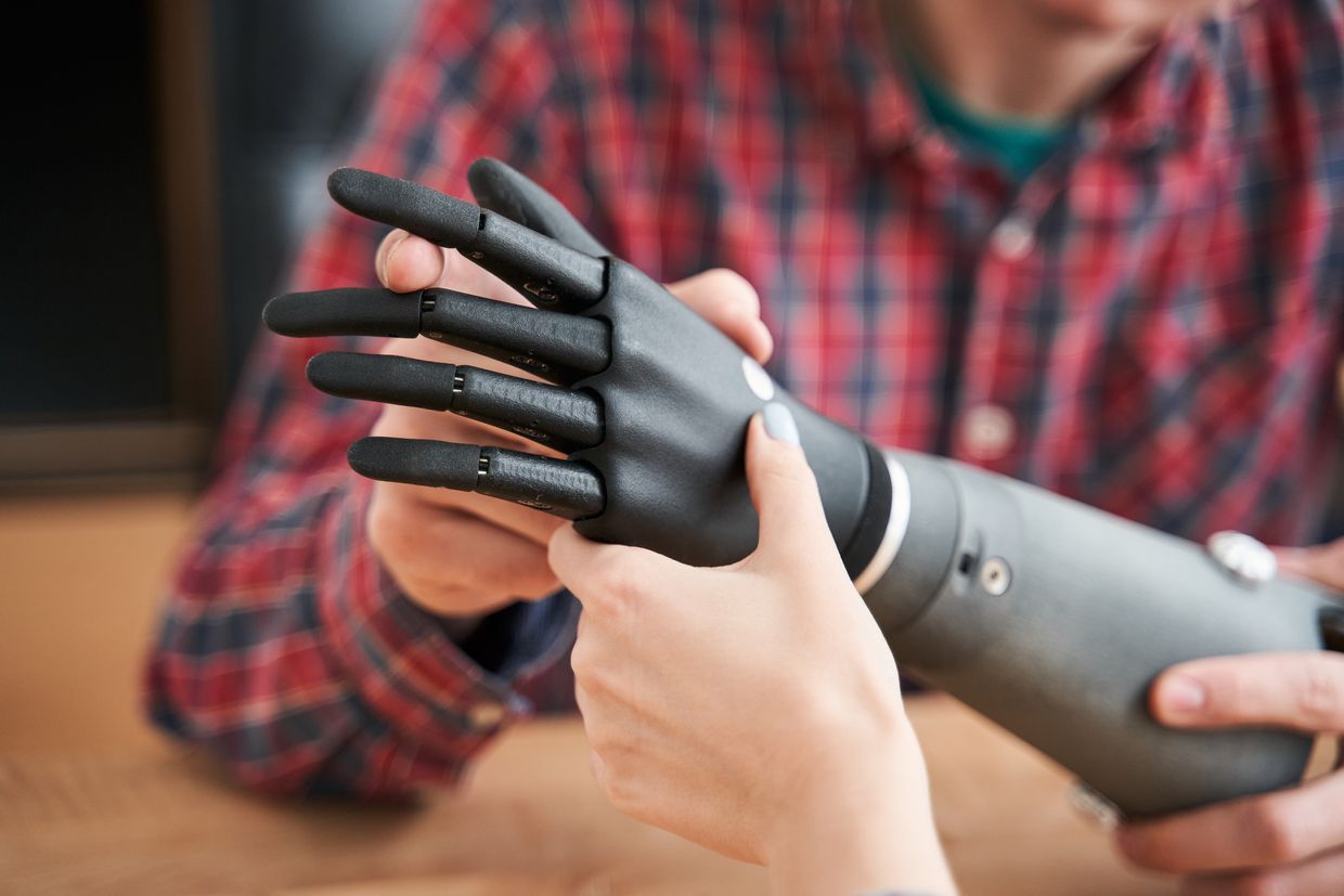 Esper Bionics hand demonstration. (Esper Bionics Press service)